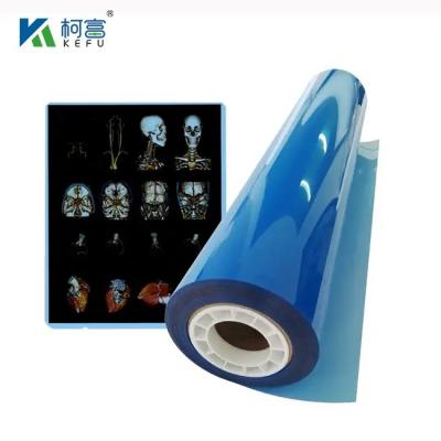 China Medical Xray Film Inkjet Film For Inkjet Printer White Blue X Ray Film for sale