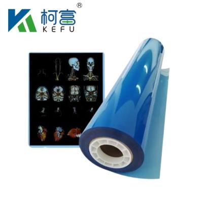 China Customized Size Blue White Inkjet Medical X Ray Film For Inkjet Printers In Sheets for sale