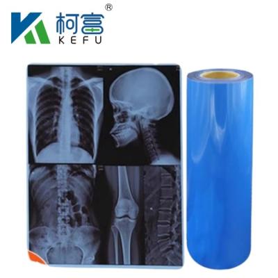 China Waterproof Medical X-Ray Thermal Film X Ray Blue Film For Inkjet Printers for sale