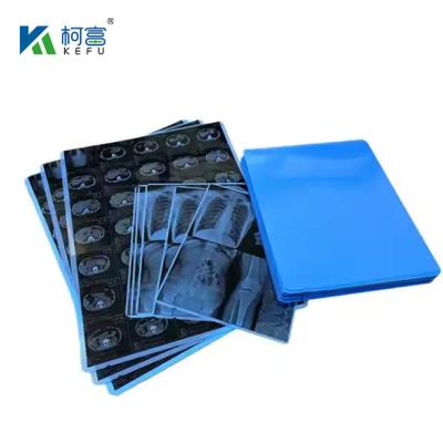 China Latest Design Customized 8*10 Inch Medical Dry X-Ray Film For Inkjet Printers for sale