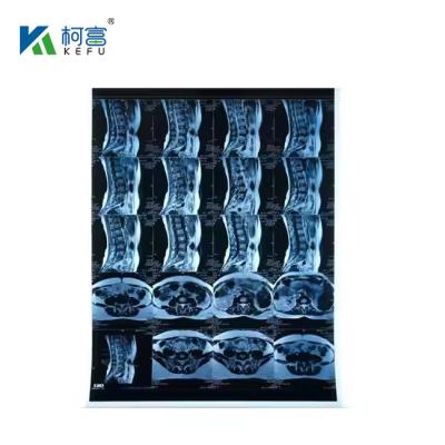 China Inkjet Medical X-RAY Blue Film 210micron CT DR Film A4 8x10 Sheet Or Roll For Medical Inkjet Printing Media for sale