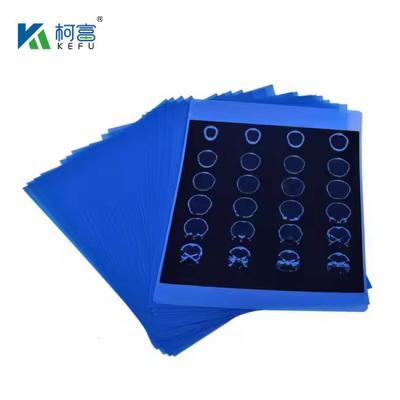 China Diagnostic Accuracy Medical X Ray Film With High Fidelity Color Reproduction for sale