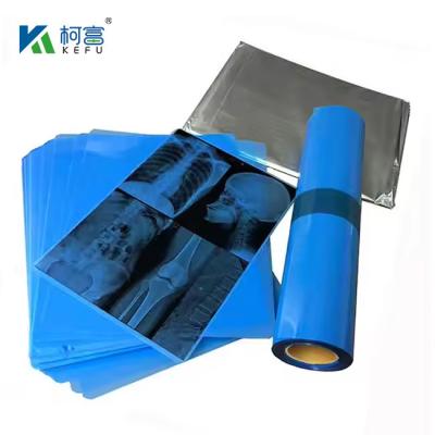 China High-Definition Medical X Ray Film For Accurate And Clear Imaging In Domestic And International Markets for sale