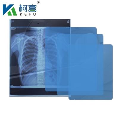 China Fábrica Fabricação Fornecimento 8x10 10x12 10x14 14x17 polegadas Médico Seco DIHL Film Laser Xray Film para Clínica e Hospitais à venda