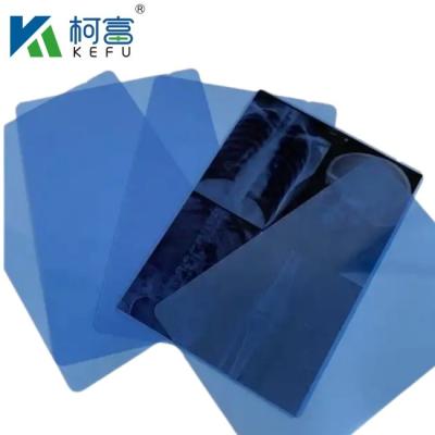 China Warm verkoop Blauwe Film Inkjet X-Ray Printing 8'*10' Plaat PET Inkjet Blauwe Film Medische Droge Röntgenfilm Te koop