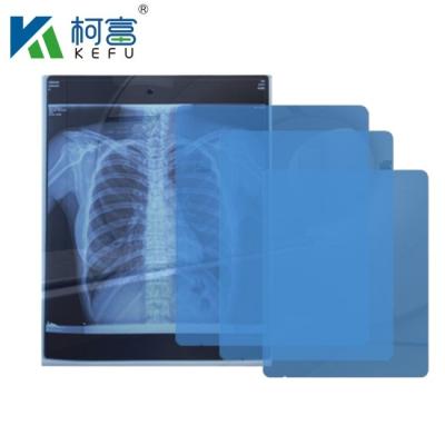 China Preço de fábrica Venda direta Filme médico de raios X Azul Filme médico sensível de raios X Filme médico a jato de tinta à venda