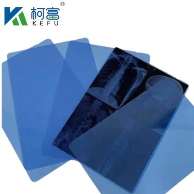 China Laser Thermal Printing X Ray Films Semi-Transparent X-ray Inkjet Medical Blue Film for sale