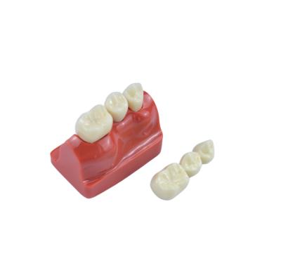 China Dental Teaching Free Sample Wholesale Dental Teeth Implant Tooth Teeth Bridge Model for sale