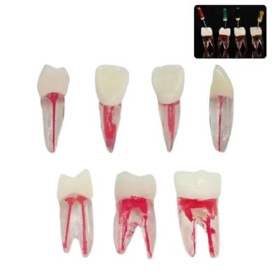 China Dental Teaching Practice A+ Grade Grade Dental Root Canal Endodontic Treatment Tooth Model For Teaching for sale