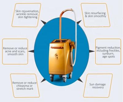 China Pigment Fractional Removal 2020 Er Yag Laser Erbium Glass Laser 1550nm Erbium Fiberglass Laser for sale