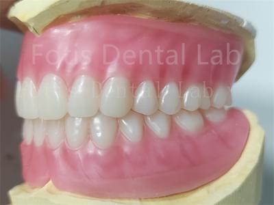 Cina OEM Dentiera acrilica completa superiore e inferiore Resistenza alle macchie Colore naturale in vendita