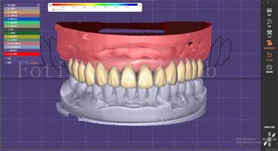 China Serviço de Desenho de Dentes Dentários com Planejamento de Prótese e Desenhos de Implantes Orais à venda