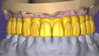 China Profissional de 3 formas de design de coroa Excelente desempenho e durabilidade à venda