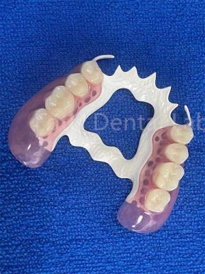 China Resistente a las manchas Dentes removibles Parciales estables Sustituir prótesis de dientes faltantes en venta