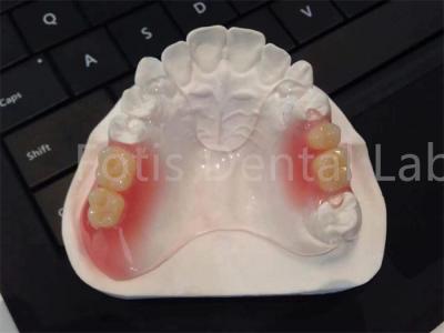 China Flexible TCS Valplast Dental Appliances Comfortable Durable Design for sale