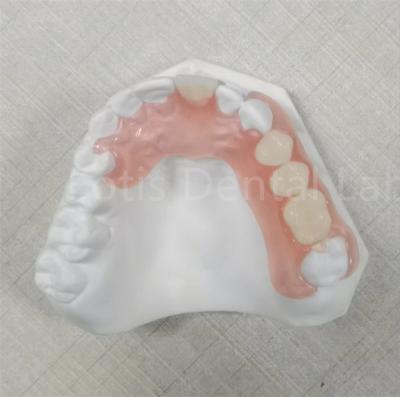 China Pink / Transparent TCS Valplast Odor Resistant Flexible Dental Prosthesis for sale