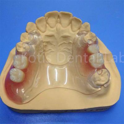 China Easy To Clean And Adjust Partial Dental Prosthesis Durable Comfortable for sale