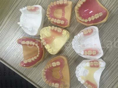 China Flexible TCS Valplast Removable Partial Denture Easy To Adjust for sale