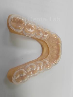 China Ergonomische harte weiche Occlusal Guard weiche Zähne Schutz langfristige Verwendung zu verkaufen