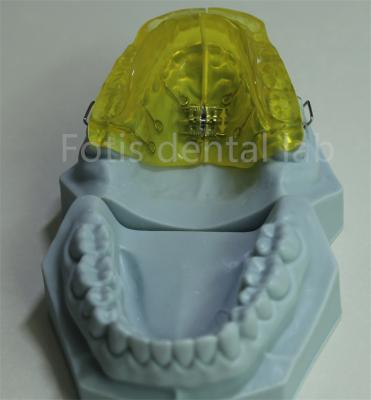 China Customizable Orthodontic Retainer for China Dental Lab for sale