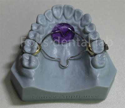 China Dental Lab Affordable Orthodontic Expander Retainer Effective In Retaining And Expanding Teeth for sale