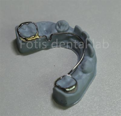 China China Dental Lab Orthodontic Retainer For Teeth Expansion for sale