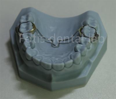 China Versatile Dental Expander Retainer Affordable Solution for Most Orthodontic Treatments for sale