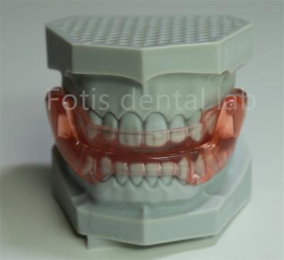 China OEM Orthodontic Retainer Expander All Sizes Compatible With Most Orthodontic Treatments for sale