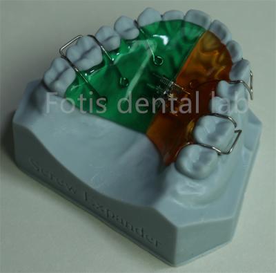 China Versatile and Comfortable Orthodontic Retainer Expander for Effective Teeth Retention for sale