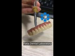 zirconia all-on-4 implant procedure same day recovery minimal follow up needed