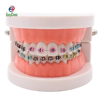 China For Teach Cure Dental Orthodontic Model With Ortho Metal Ceramic Arch Wire Bracket Buccal Tube Ligation Ties Other Dental Equipments for sale