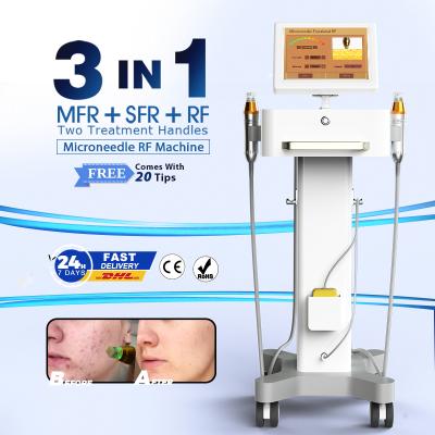 China Face lift microneedle face skin rejuvenation microneedle beauty facial lifting machine for salon for sale