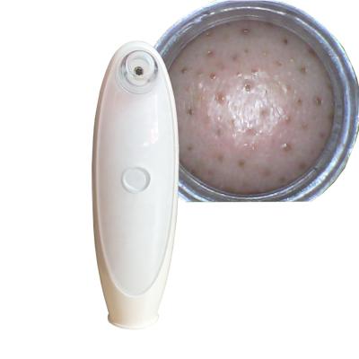 China Black Head Removal Blackhead Remover Video Vacuum With App In Multifunction Beauty Equipment for sale