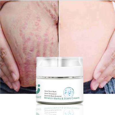 China Effective Scar Mark Stretch Scars Pregnancy Deep Removal Repair Treatment Create Strong And Smooth Skin Cream for sale