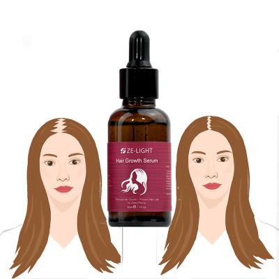 China FREE SAMPLE Private Label Hair Growth Products Hair Loss Prevention Fast Hair Loss Growth Serum For Women Men for sale