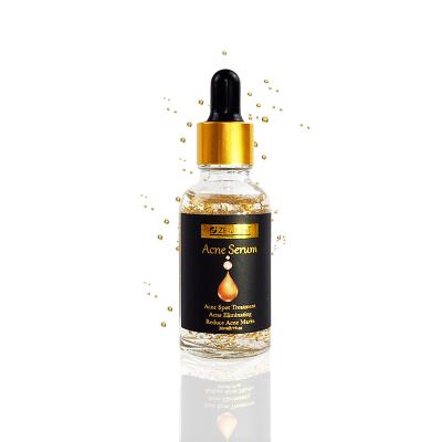 China Acne Treatment Eliminating Reduce Acne Spot Mark Treatment Wholesale Face 24k Gold Serum for sale