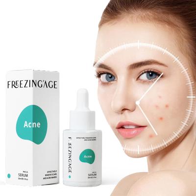 China Skin Revitalizer Acne Pimple Anti Peeps Shrink Marks Removing Scars Remove Treatment Facial Serum for sale