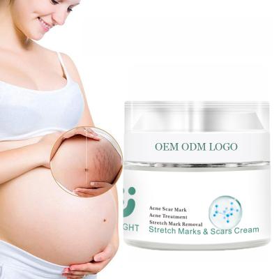 China Mark Oem Private Label Scar Removing Stretch Mark Cream for sale