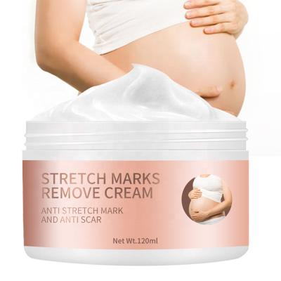 China Best Vegan Private Label Skin Revitalizer Natural Anti Postpartum Scar Removal Natural Stretch Mark Cream For Pregnancy Women for sale