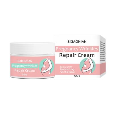 China Skin Revitalizer Ready to Ship Natural Stretch Mark Cream for Pregnancy Women Mango Stretch Mark Removal Cream 50ml for sale