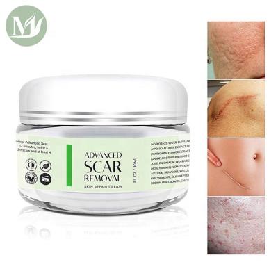 China Scar Remove Wholesales Private Label Acne Pimple Remove Pure Cream Beauty Skin Care Acne Scar Removal Cream for sale