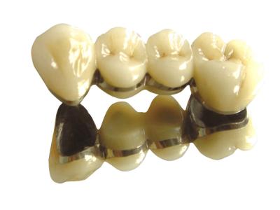 Chine Couleur des dents Cobalte Couronne de chrome PFM Dentistique haute noblesse à vendre