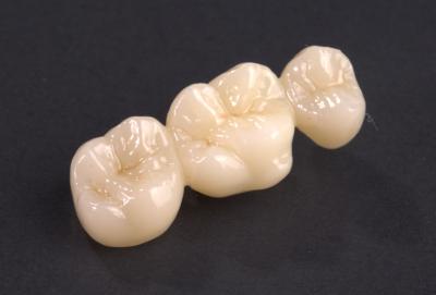 China Precise Fit Full Contour Zirconia Bridge Natural Zirconia Crown Bridge High Strength for sale