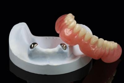 China Telescope Removable Dentures Precision Attachment Overdenture Arylic for sale