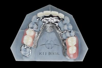 Cina Quadro in metallo di titanio Protesi removibile denti falsi personalizzati in vendita