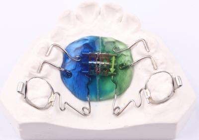 Chine Appareil de pendule de la FDA Orthodontie Appareil de pendule orthopédique personnalisable à vendre