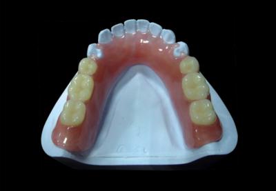 China Dentadura parcial acrílica removível rosa Dentadura parcial acrílica temporária à venda