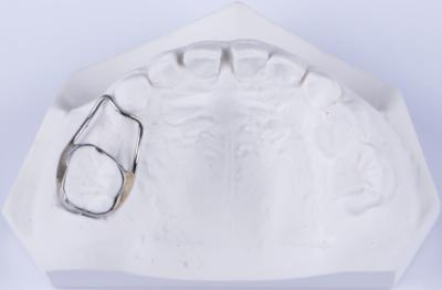 China Customizable Dental Space Retainer For Teeth Retainer To Fix Gap for sale