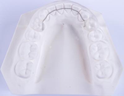 China Non Removable Lingual Wire Retainer Orthodontics Retainers To Straighten Teeth for sale