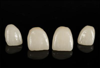 China CAD/CAM Porcelain Fused To Zirconia Bridge For Natural Looking Restoration for sale